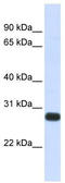Serine Peptidase Inhibitor, Kunitz Type 2 antibody, TA338452, Origene, Western Blot image 