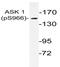 Mitogen-Activated Protein Kinase Kinase Kinase 5 antibody, AP01527PU-N, Origene, Western Blot image 