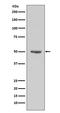 Cyclin E1 antibody, M00543-1, Boster Biological Technology, Western Blot image 