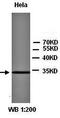 Cyclin Dependent Kinase 4 antibody, orb77309, Biorbyt, Western Blot image 