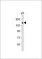 Tet Methylcytosine Dioxygenase 1 antibody, MBS9206951, MyBioSource, Western Blot image 