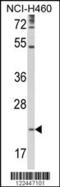 Tetraspanin 31 antibody, 63-533, ProSci, Western Blot image 