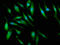 Protein-L-Isoaspartate (D-Aspartate) O-Methyltransferase antibody, LS-C671021, Lifespan Biosciences, Immunofluorescence image 
