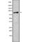 Adenosine Monophosphate Deaminase 3 antibody, abx148172, Abbexa, Western Blot image 