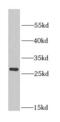 Aquaporin-0 antibody, FNab05193, FineTest, Western Blot image 
