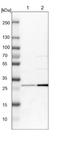 Glutamate-Cysteine Ligase Modifier Subunit antibody, NBP1-83361, Novus Biologicals, Western Blot image 