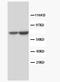 Follicle Stimulating Hormone Receptor antibody, PA1035, Boster Biological Technology, Western Blot image 