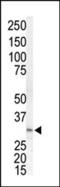 Mitogen-Activated Protein Kinase Kinase 3 antibody, MBS9207999, MyBioSource, Western Blot image 