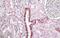 Transforming Growth Factor Beta Induced antibody, NBP1-47215, Novus Biologicals, Immunohistochemistry frozen image 