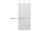 Thymidylate Synthetase antibody, A04320-1, Boster Biological Technology, Western Blot image 