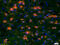 Coiled-Coil Domain Containing 12 antibody, GTX51891, GeneTex, Immunohistochemistry paraffin image 