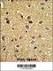 RCC1 And BTB Domain Containing Protein 2 antibody, 62-441, ProSci, Immunohistochemistry paraffin image 