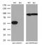Lectin, Mannose Binding 1 antibody, M03628, Boster Biological Technology, Western Blot image 