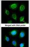 Keratin 14 antibody, PA5-28002, Invitrogen Antibodies, Immunofluorescence image 