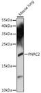 Proline Rich Nuclear Receptor Coactivator 2 antibody, 16-652, ProSci, Western Blot image 