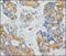 Keratin 18 antibody, 251733, Abbiotec, Immunohistochemistry paraffin image 