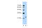 Ubiquitin Protein Ligase E3 Component N-Recognin 7 (Putative) antibody, 29-849, ProSci, Western Blot image 