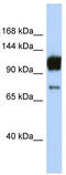 ATP Binding Cassette Subfamily A Member 2 antibody, TA332134, Origene, Western Blot image 