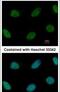 Zinc Finger E-Box Binding Homeobox 1 antibody, PA5-28221, Invitrogen Antibodies, Immunofluorescence image 