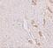 Leucine Rich Repeat Transmembrane Neuronal 1 antibody, NBP1-76528, Novus Biologicals, Immunohistochemistry paraffin image 