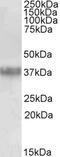 Estrogen Receptor 2 antibody, 43-061, ProSci, Western Blot image 