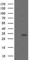 Proteasome Inhibitor Subunit 1 antibody, TA505275BM, Origene, Western Blot image 