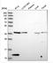 Coagulation Factor VIII Associated 3 antibody, NBP2-54731, Novus Biologicals, Western Blot image 