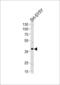 Serpin Family I Member 1 antibody, 55-159, ProSci, Western Blot image 