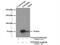 Protein Phosphatase 2 Regulatory Subunit B'Delta antibody, 12068-1-AP, Proteintech Group, Immunoprecipitation image 