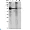 Aldehyde Dehydrogenase 1 Family Member A1 antibody, LS-C813979, Lifespan Biosciences, Immunohistochemistry paraffin image 