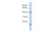 TBC1 Domain Family Member 21 antibody, A14405, Boster Biological Technology, Western Blot image 