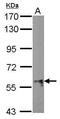 Activin A Receptor Type 1B antibody, PA5-29219, Invitrogen Antibodies, Western Blot image 