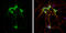 Calcium/Calmodulin Dependent Protein Kinase II Alpha antibody, GTX127939, GeneTex, Immunofluorescence image 