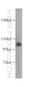 Alanyl-TRNA Synthetase antibody, 17394-1-AP, Proteintech Group, Western Blot image 