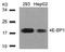 Eukaryotic Translation Initiation Factor 4E Binding Protein 1 antibody, AP02725PU-N, Origene, Western Blot image 