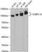Oxysterol Binding Protein Like 10 antibody, 14-846, ProSci, Western Blot image 