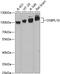 OSBP9 antibody, 14-846, ProSci, Western Blot image 