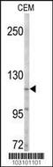 ACK1 antibody, MBS9205935, MyBioSource, Western Blot image 