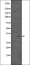 Cyclin Dependent Kinase 12 antibody, orb336535, Biorbyt, Western Blot image 