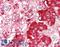 Mitochondrial Antiviral Signaling Protein antibody, LS-C187776, Lifespan Biosciences, Immunohistochemistry paraffin image 