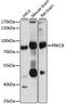 Protein Kinase C Beta antibody, STJ29922, St John