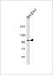 Glutamate Metabotropic Receptor 7 antibody, 58-462, ProSci, Western Blot image 