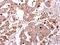 Galactosidase Beta 1 antibody, GTX104360, GeneTex, Immunohistochemistry paraffin image 