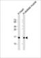Tumor Suppressor 2, Mitochondrial Calcium Regulator antibody, MA5-24739, Invitrogen Antibodies, Western Blot image 