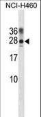 Protein phosphatase inhibitor 2 antibody, LS-C155937, Lifespan Biosciences, Western Blot image 