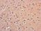 Proteasome 26S Subunit, Non-ATPase 6 antibody, PA5-30333, Invitrogen Antibodies, Immunohistochemistry frozen image 