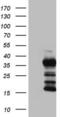 Thyroglobulin antibody, LS-C789212, Lifespan Biosciences, Western Blot image 