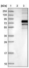 Protein O-Linked Mannose N-Acetylglucosaminyltransferase 2 (Beta 1,4-) antibody, NBP1-89205, Novus Biologicals, Western Blot image 