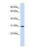 Cytochrome B5 Domain Containing 2 antibody, NBP1-91430, Novus Biologicals, Western Blot image 