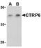 C1q And TNF Related 6 antibody, ADI-905-719-100, Enzo Life Sciences, Western Blot image 